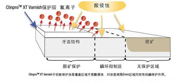 3M玻璃离子保护膜