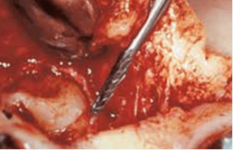 def9e769c0f44aa3af3ac6bf43a146d2.png def9e769c0f44aa3af3ac6bf43a146d2.png