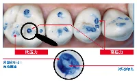 宝诗咬合纸
