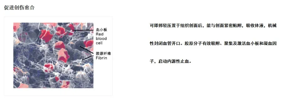 可即邦 医用胶原蛋白海绵3.webp