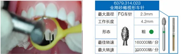 6379.webp 6379.webp