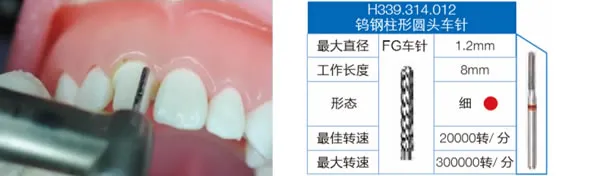 H339.webp H339.webp
