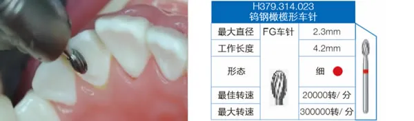H379.webp H379.webp
