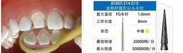 858EF.webp 858EF.webp