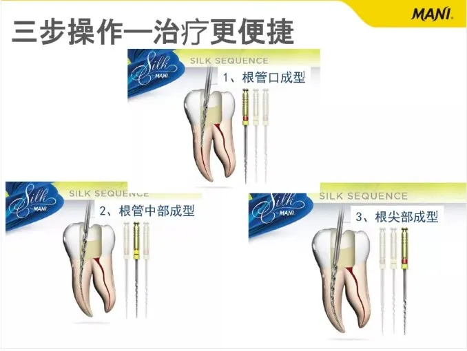 3.webp