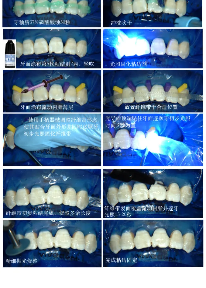 Seal-Bond Ultima粘接剂3.webp Seal-Bond Ultima粘接剂3.webp