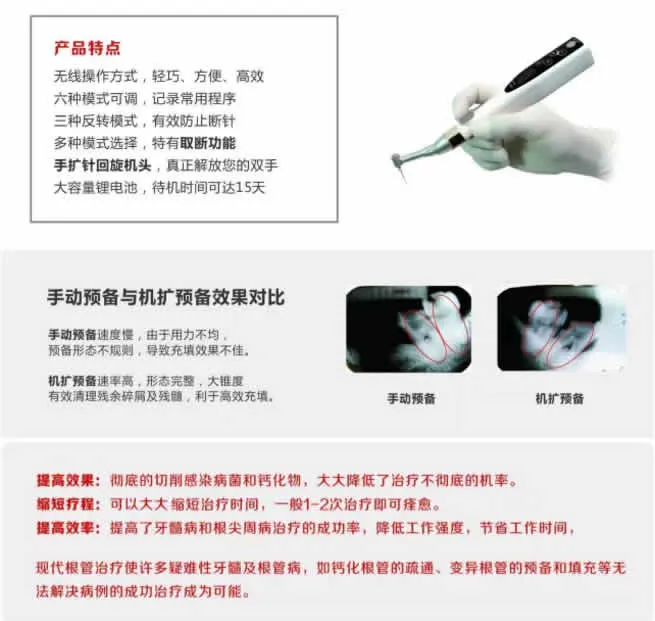 得悦Free Motor根管治疗仪-3.webp