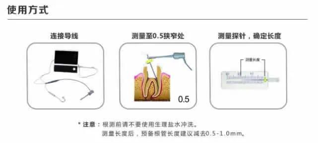 得悦Free Pex电子根尖测定仪-2.webp
