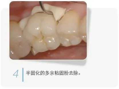 image.webp image.webp