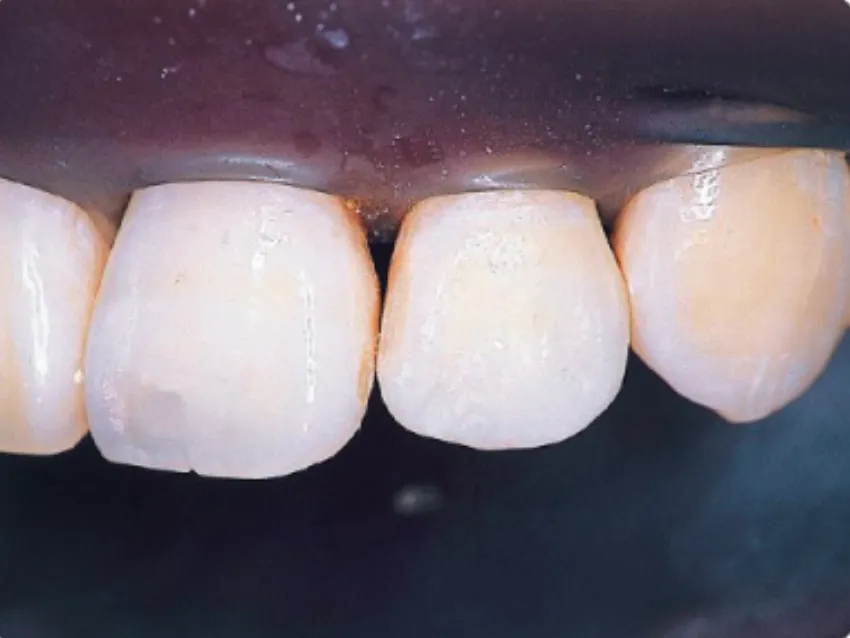 1010.webp