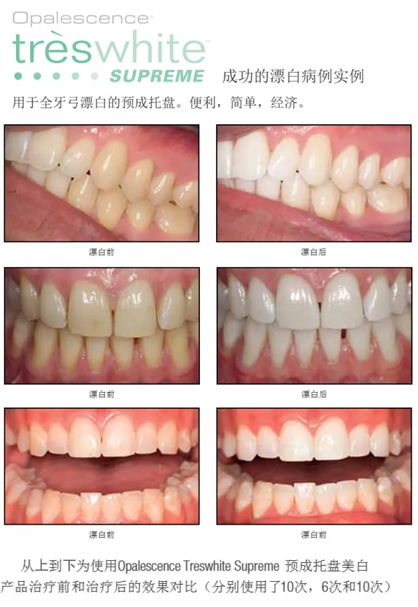 皓齿居家美白5.webp 皓齿居家美白5.webp