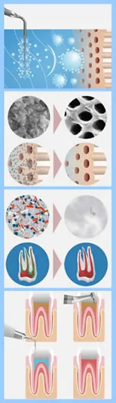 八颗牙根管荡洗原理图.webp