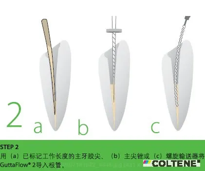 康特 GuttaFlow 2根管充填常温流动牙胶.webp 康特 GuttaFlow 2根管充填常温流动牙胶.webp
