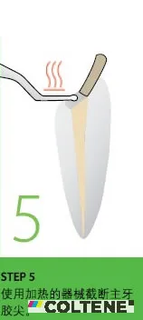 康特 GuttaFlow 2根管充填常温流动牙胶5.webp 康特 GuttaFlow 2根管充填常温流动牙胶5.webp