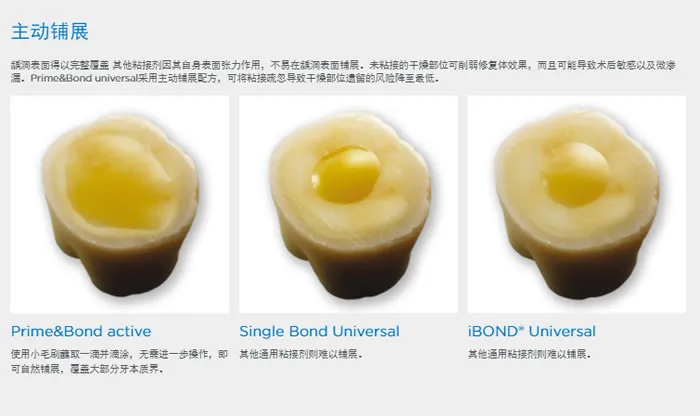 登士柏 Prime Bond八代粘结剂b.webp