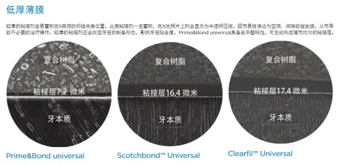 登士柏 Prime Bond八代粘结剂c.webp