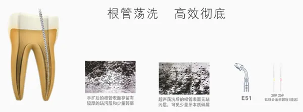啄木鸟 超声洁牙机U600 a.webp