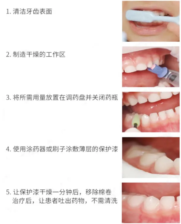 义获嘉 氟保护剂（氟齿乐.webp