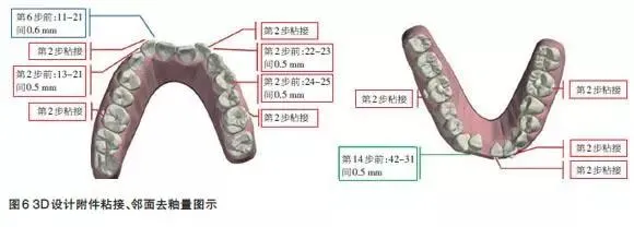 DZ-7.webp