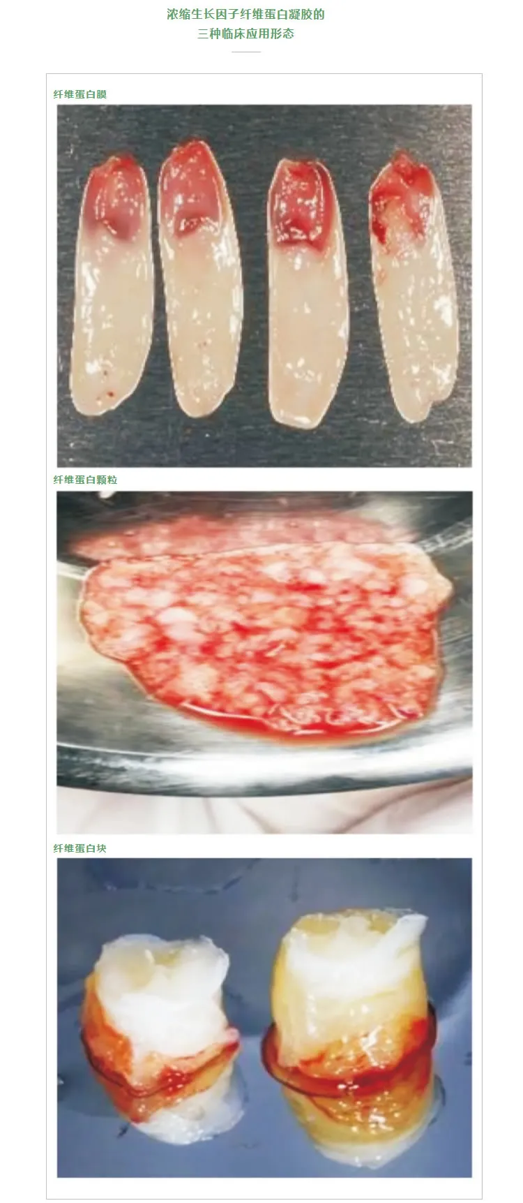 湘启   TD4E口腔专用离心机2_r2_c1.webp