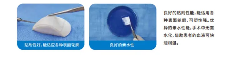 兰度 骨膜1_r7_c1.webp
