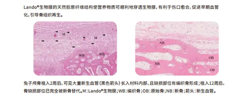 兰度 骨膜1_r5_c1.webp