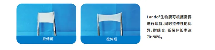 兰度 骨膜1_r8_c1.webp
