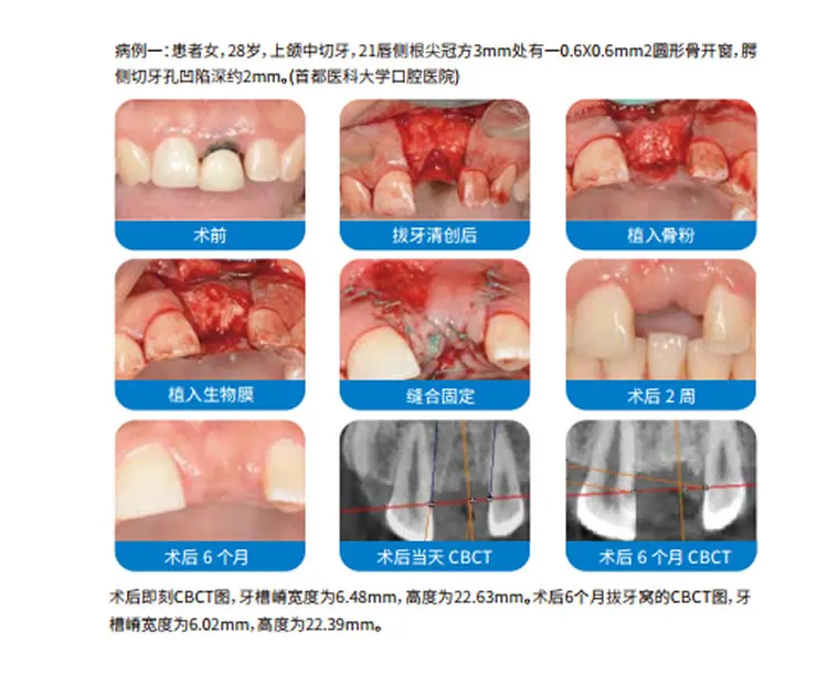兰度 骨膜1_r10_c1.webp