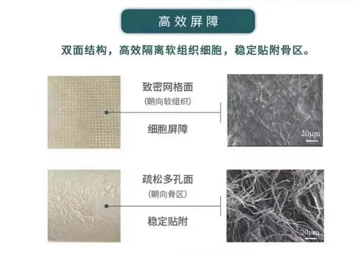 瑞拜欧 骨膜1_r3_c1.webp 瑞拜欧 骨膜1_r3_c1.webp