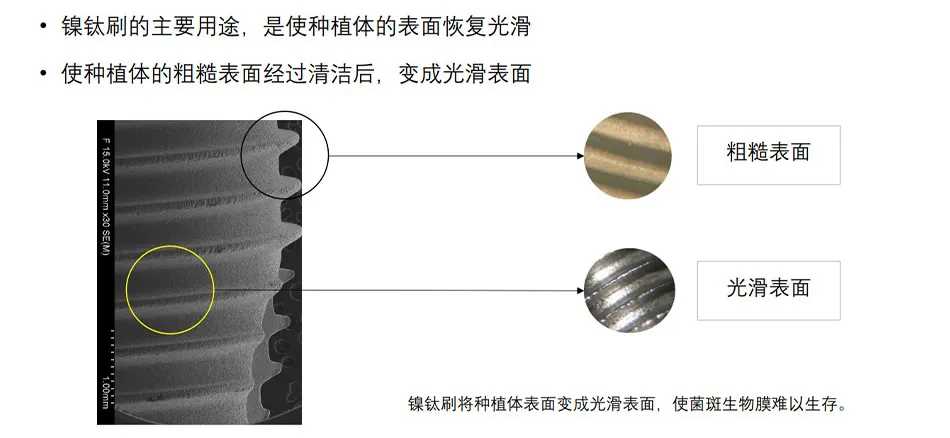 钛刷_r2_c1.webp 钛刷_r2_c1.webp