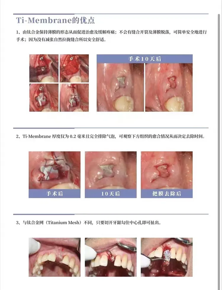伊诺 钛膜 (2).webp