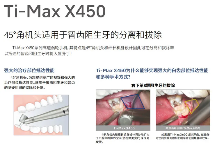 NSK Ti-Max X450 QD拔牙手机 不带灯 【 p1086】-1.webp