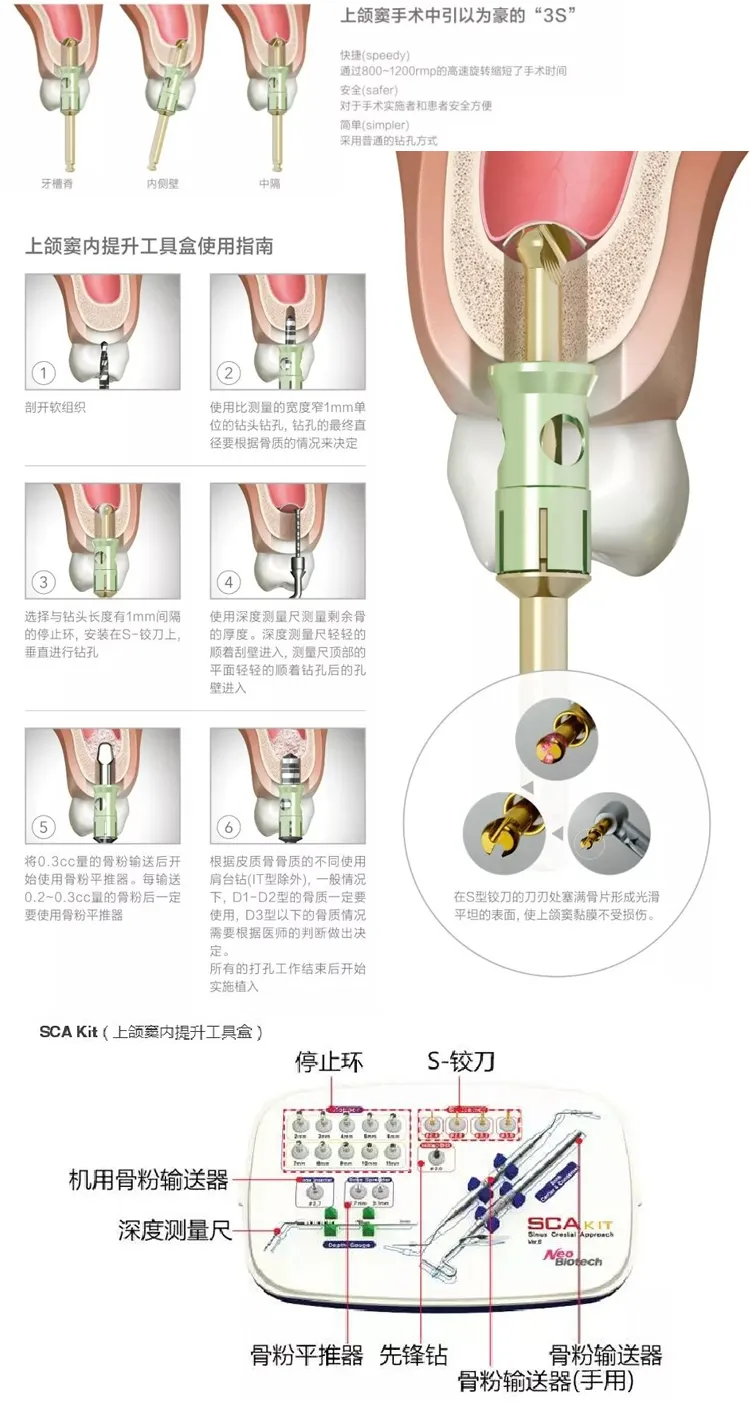 纽百特 上颌窦内提工具盒-1.webp