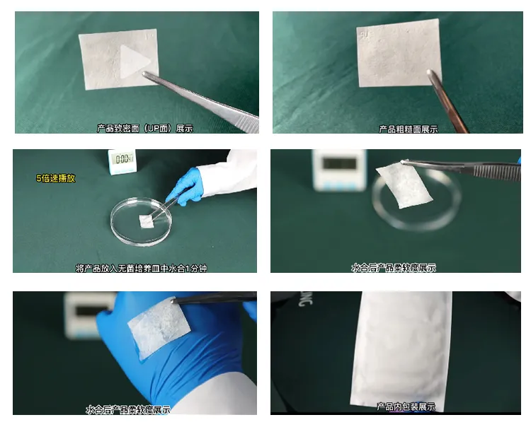 博瑞金 口腔修复膜15-18-1.webp