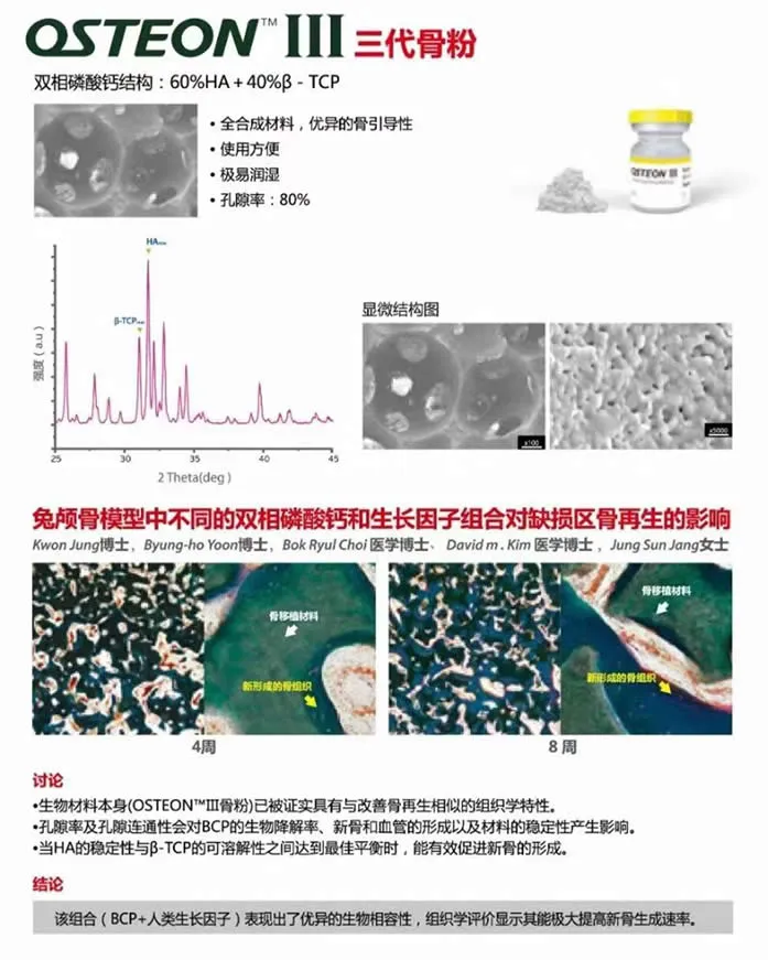 登腾 OSTEON3代骨粉.webp