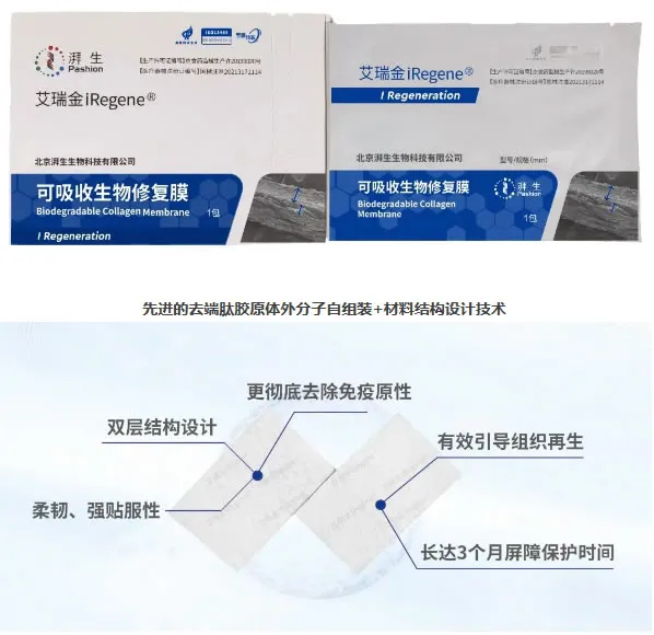 艾瑞金 生物膜.webp