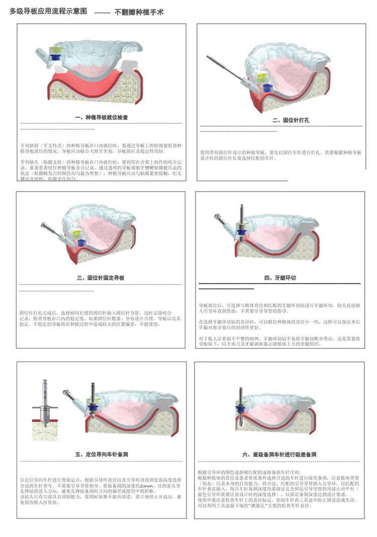 西科玛 全程导板工具盒-2_r3_c1.webp