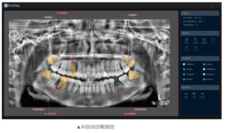 博爵CBCT系列详情-1_r9_c1.webp 博爵CBCT系列详情-1_r9_c1.webp
