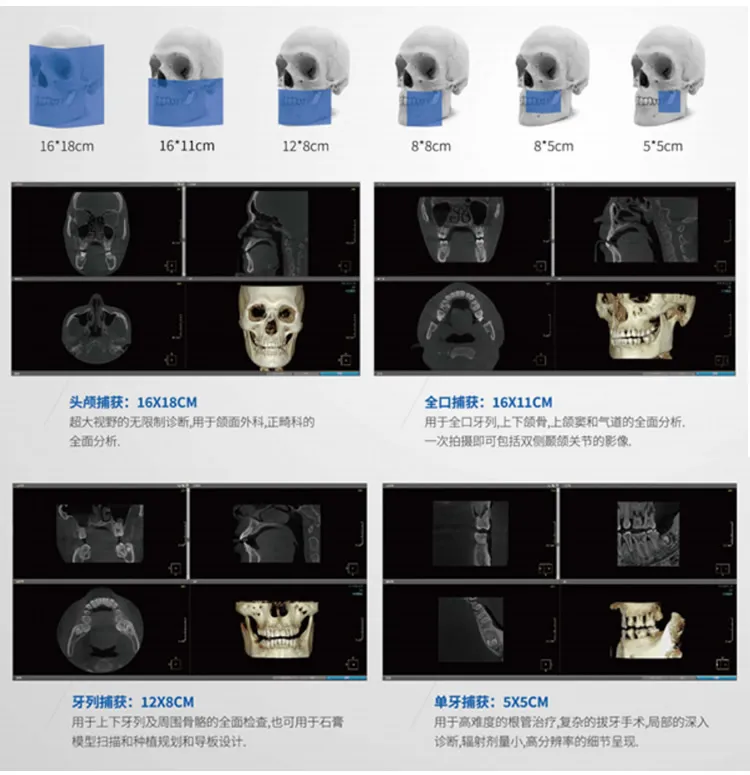 博爵CBCT系列详情-1_r4_c1.webp 博爵CBCT系列详情-1_r4_c1.webp