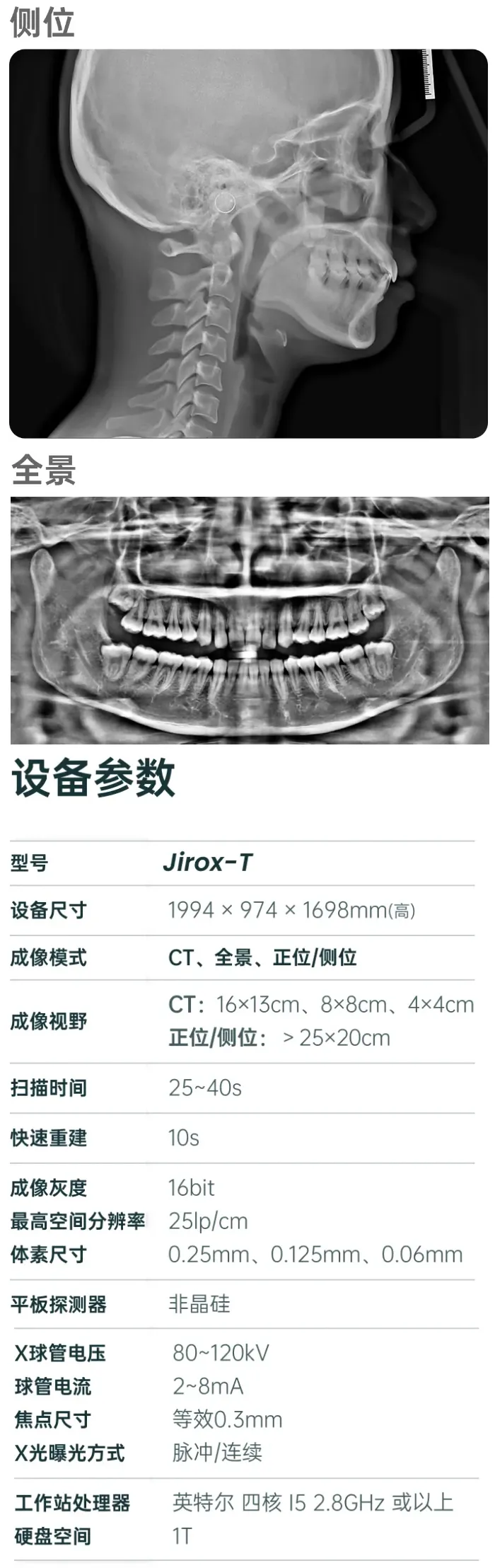 有方医疗CT2.webp