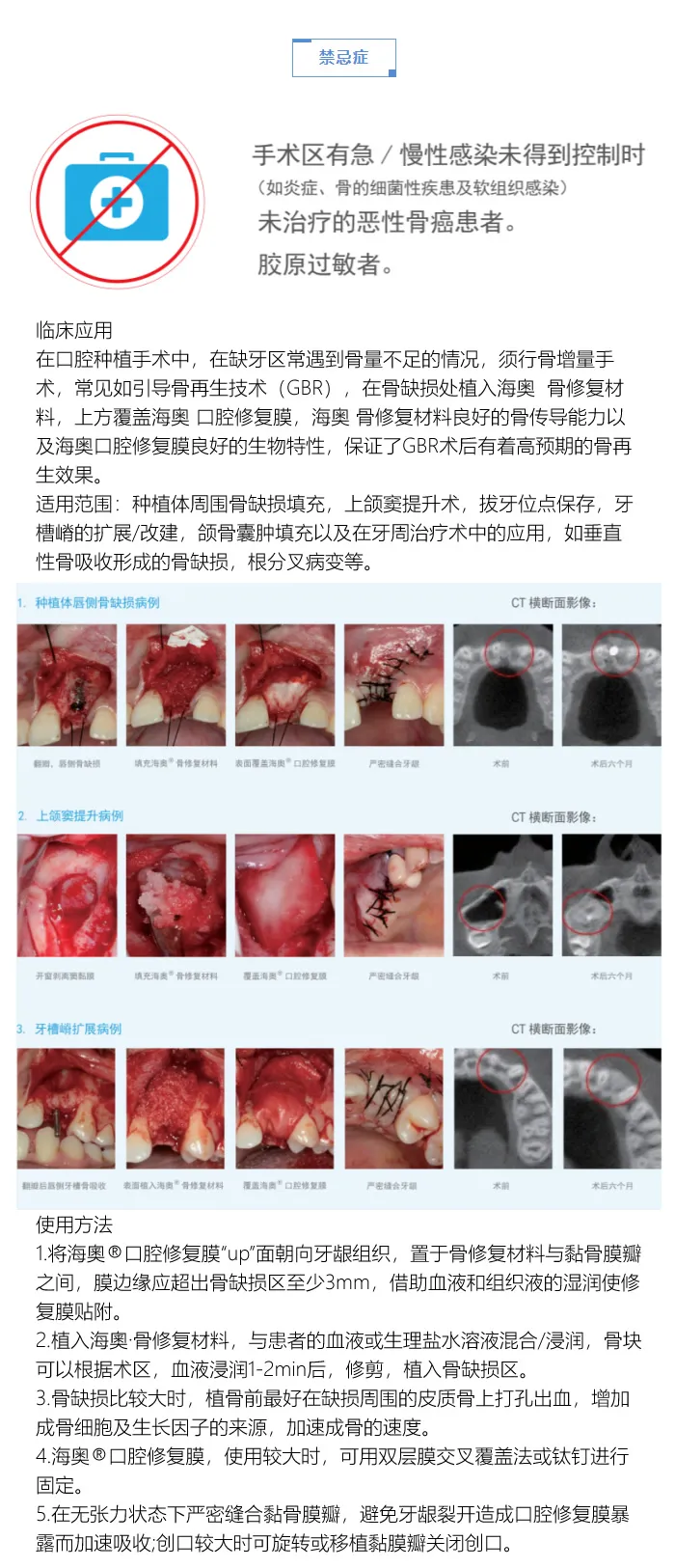 海澳骨粉2.webp