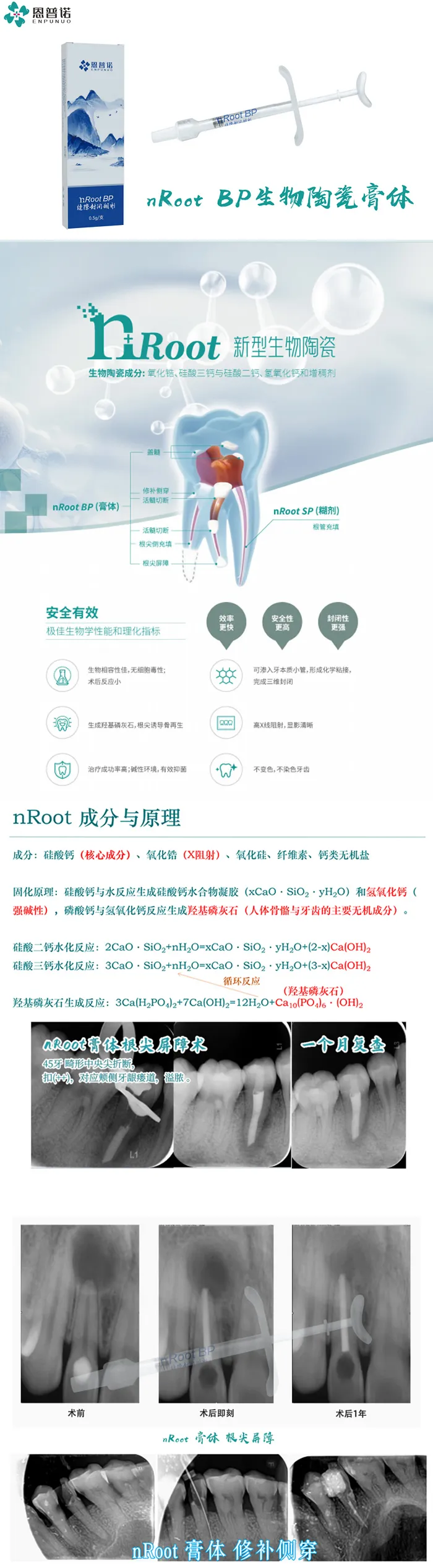 恩普诺   nRoot BP缝隙封闭糊剂1 .webp