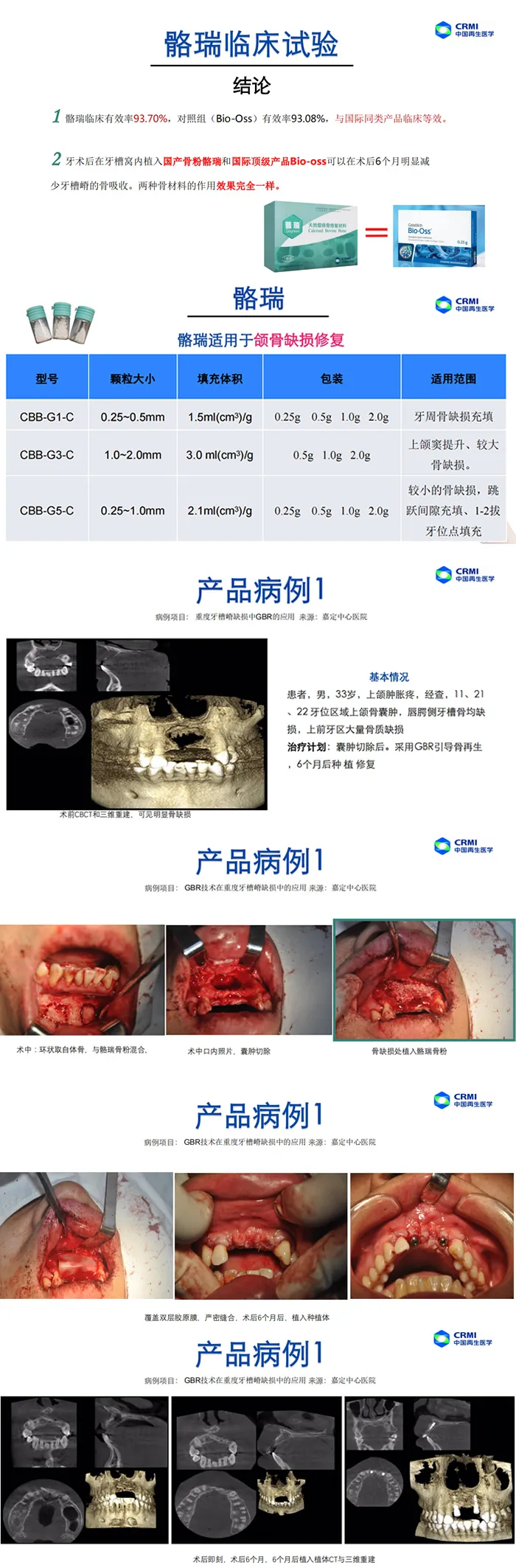 骼瑞 天然煅烧骨修复材料骨粉1.webp
