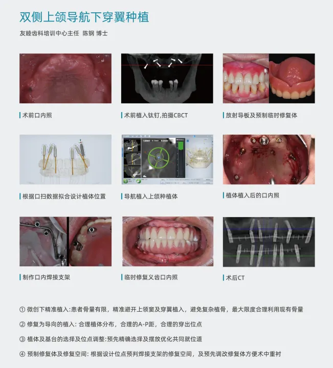 image.webp