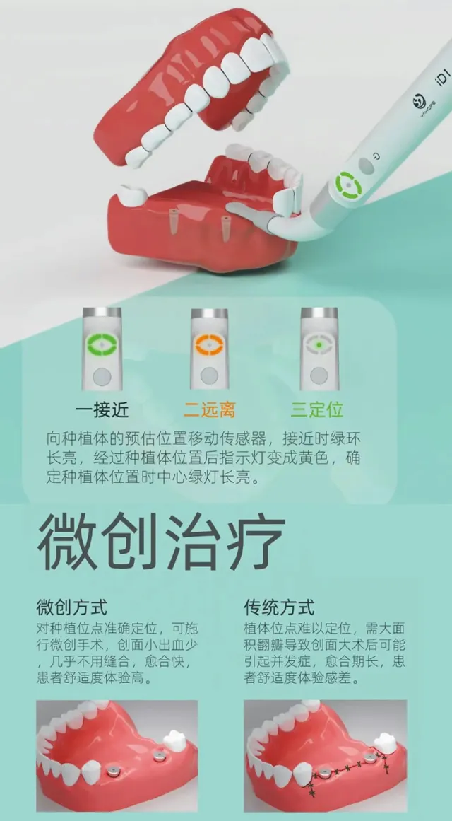 精工 种植定位仪-微创治疗仪iD1-2.webp