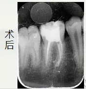image.webp