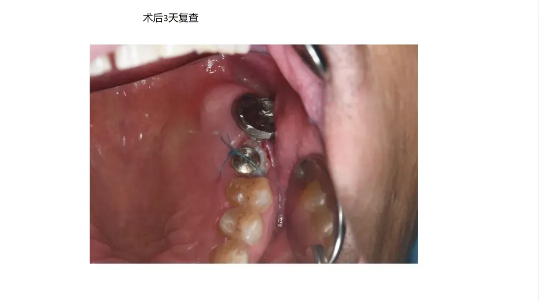 ece560fa-89ef-450d-abf7-d3d99221e6d6.webp
