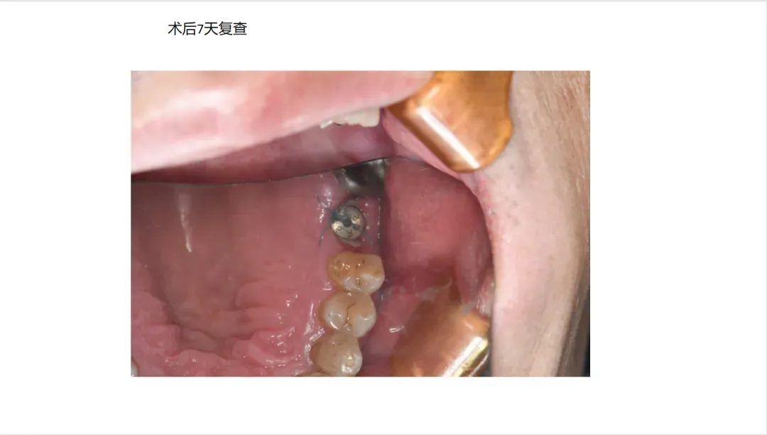83f4f0f4-0d9d-43f1-876c-04634f46411d.webp