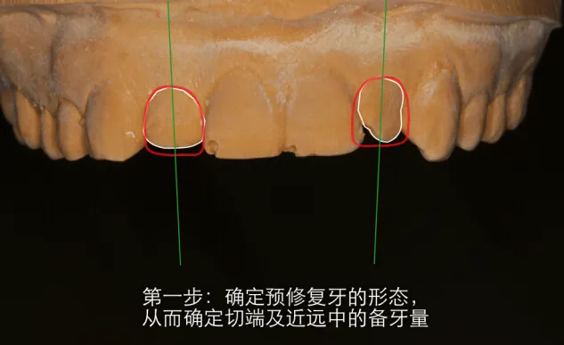 美学蜡型---简易操作理念