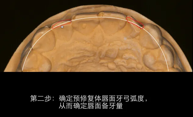 美学蜡型---简易操作理念